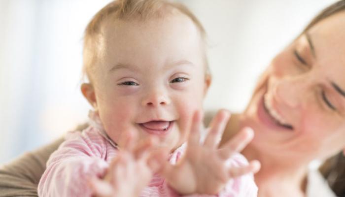 متى يبتسم الطفل المصاب بمتلازمة داون؟ ما أهم أعراض المتلازمة عند الأطفال وطرق الكشف المبكر عنها؟